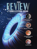 Review of Cornea & External Disease 2024